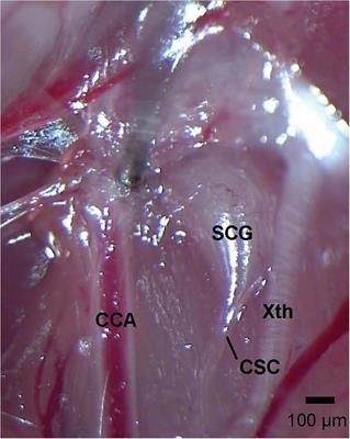 Loss of Cervical Sympathetic Chain Input to the Superior Cervical Ganglia Affects the Ventilatory Responses to Hypoxic Challenge in Freely-Moving C57BL6 Mice